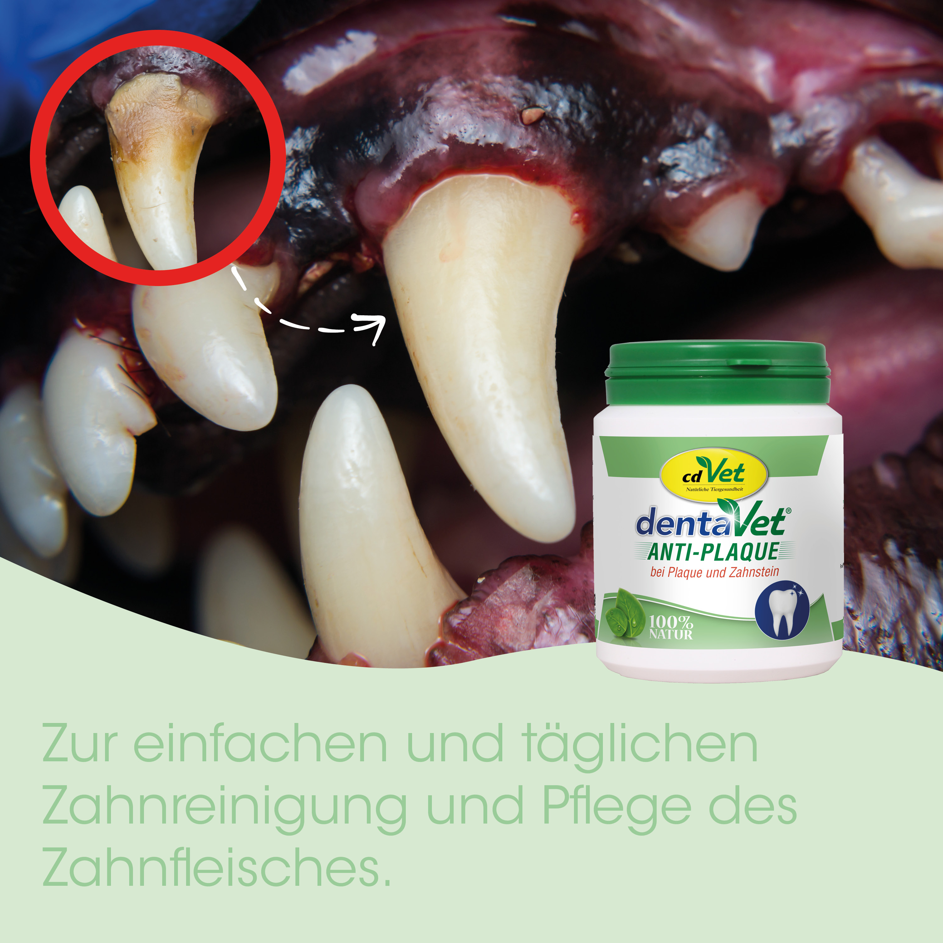 zahnfleisch, fang, zahnpflege, anti-plaque, kapsel